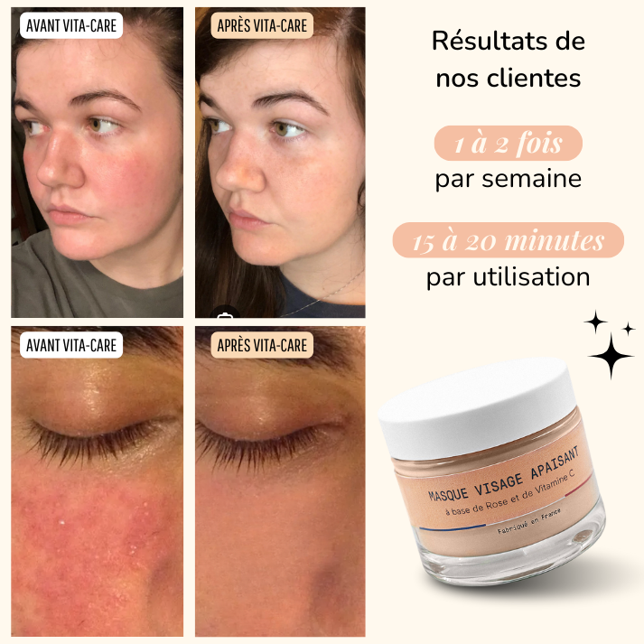 Masque apaisant à la Rose + Pinceau OFFERT