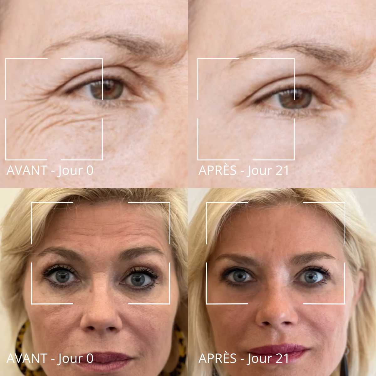 Routine anti-âge