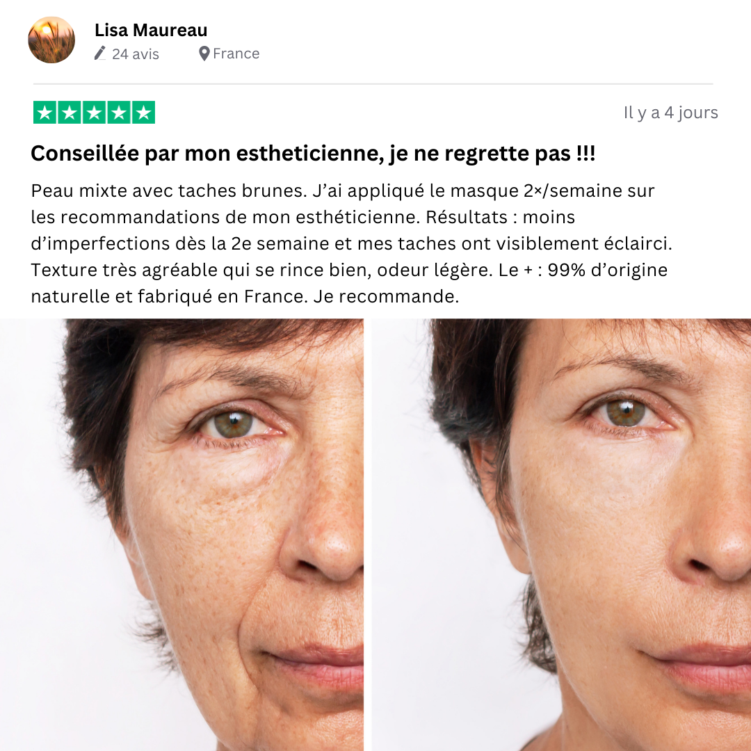 Masque anti-taches au Curcuma