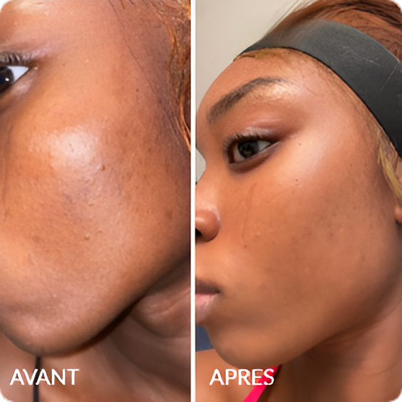 Avant / Après de Wendy P.