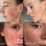 Masque anti-rougeurs Rose & Vitamine C