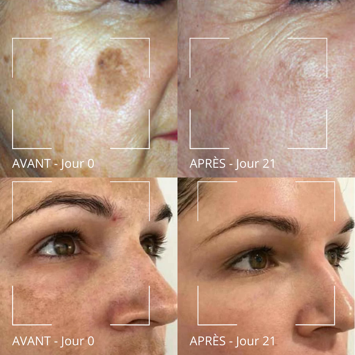 Masque anti-taches Curcuma & Vitamine C