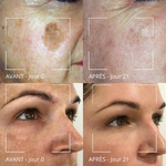 Masque anti-taches Curcuma & Vitamine C