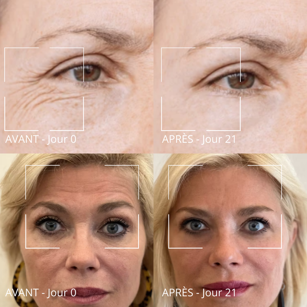 Routine anti-âge