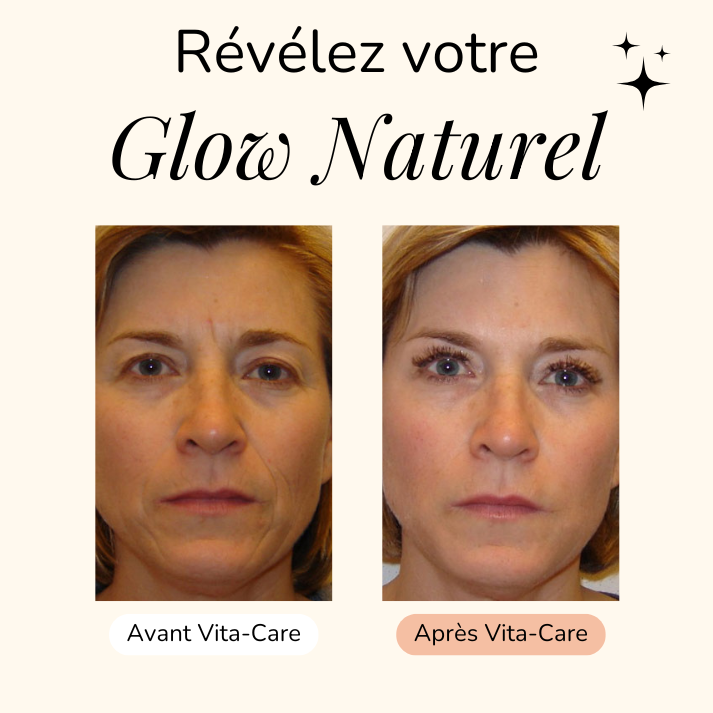 Masque anti-âge à l'Aloe Vera + Pinceau OFFERT