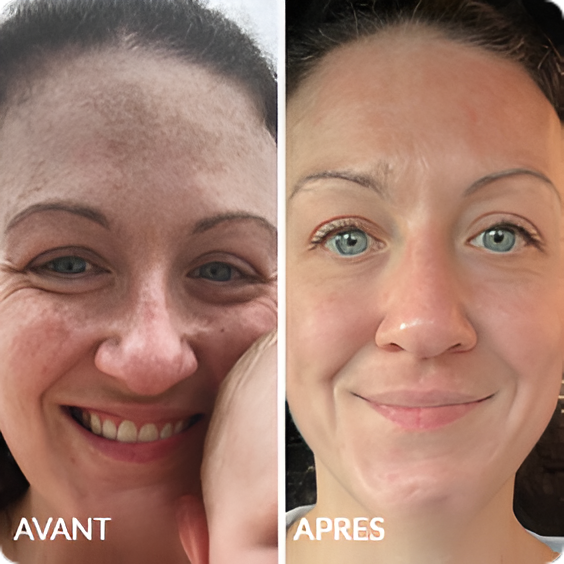 Avant / Après de Muriel G.