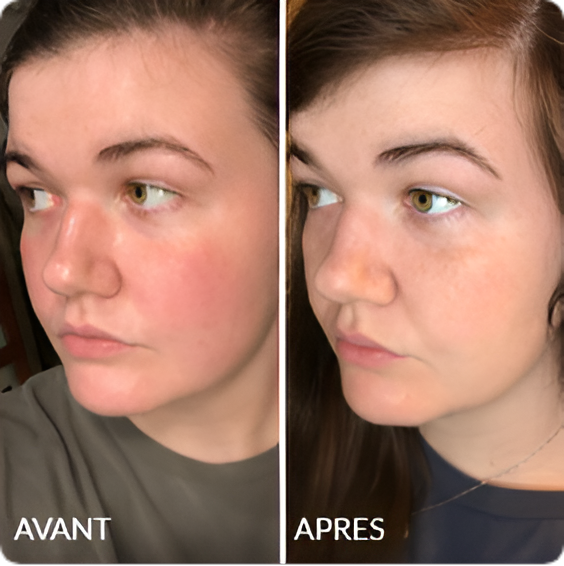 Avant / Après de Julie N.