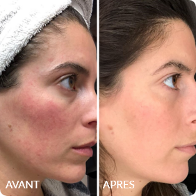 Avant / Après de Julie R.