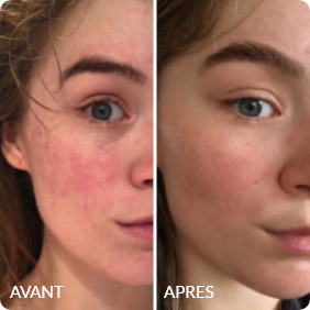 Avant / Après de Pauline P.