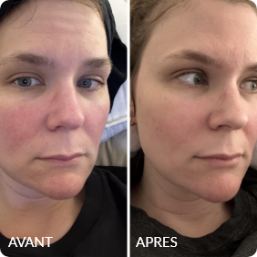 Avant / Après de Amélie D.