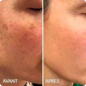 Avant / Après de Carole E.