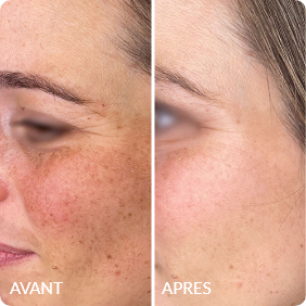 Avant / Après de Julie N.