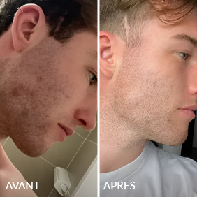 Avant / Après de Damien D.