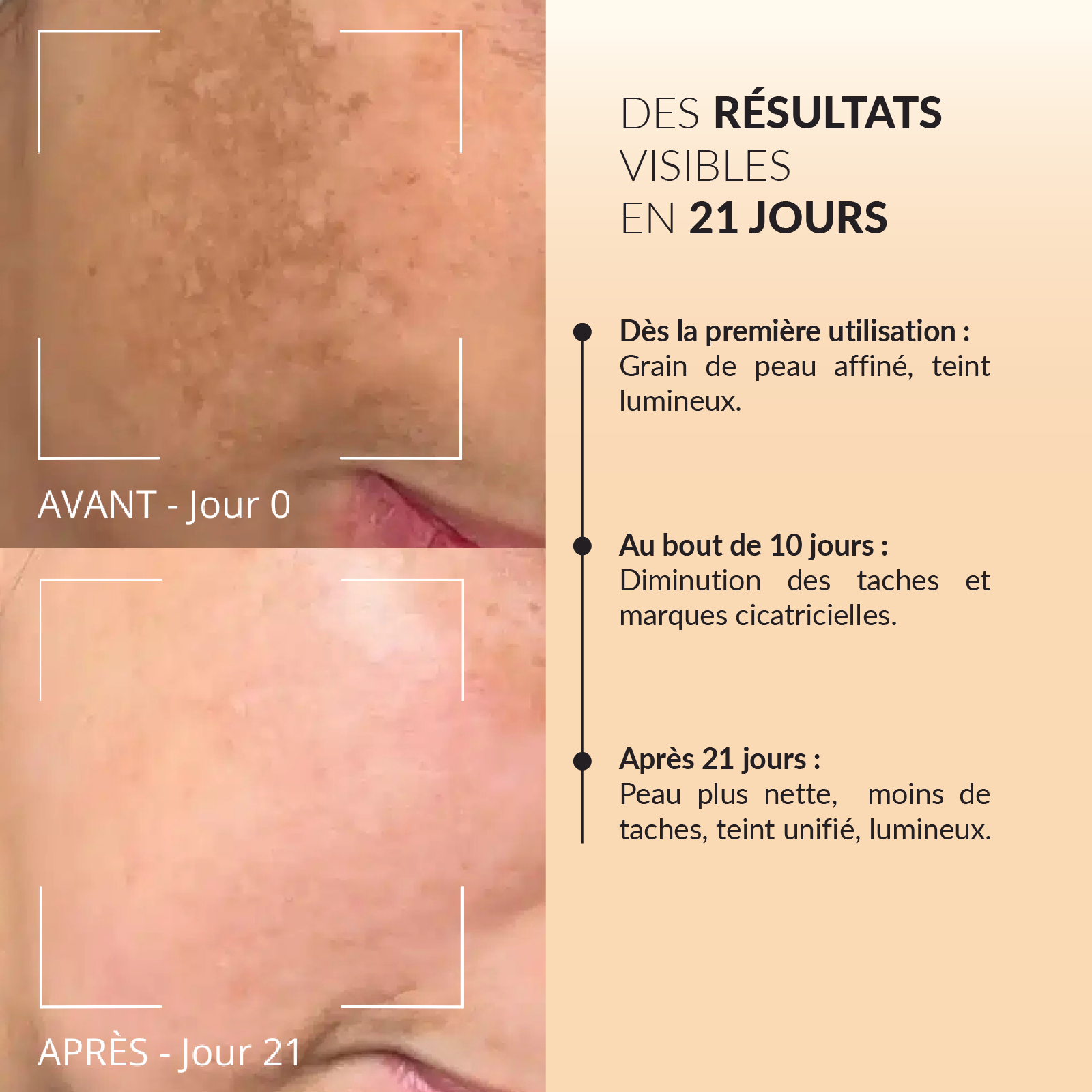 Masque anti-taches Curcuma & Vitamine C