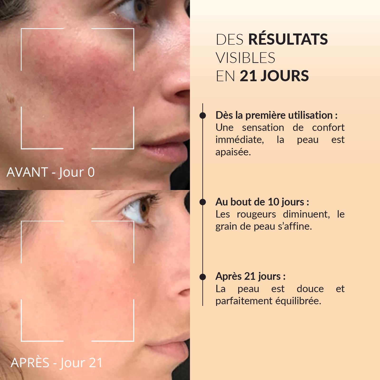 Masque anti-rougeurs Rose & Vitamine C